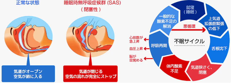 SASについて